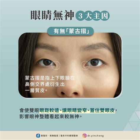 戴眼鏡眼鏡變小|整形外科 鄭穎醫師